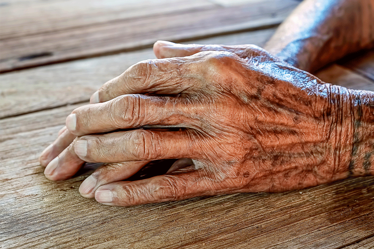 تغییرات پوستی