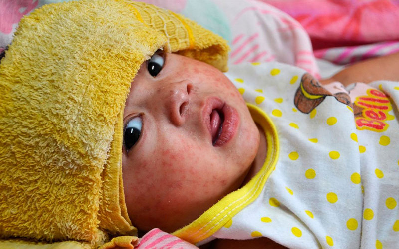 سرخک در کمین بهار ایران