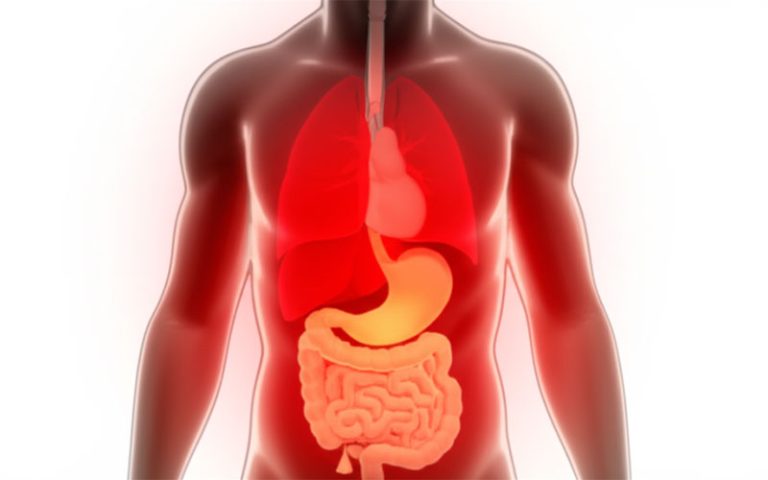 سوزش سردل؛ آژیر خطر رفلاکس معده در ایرانیان